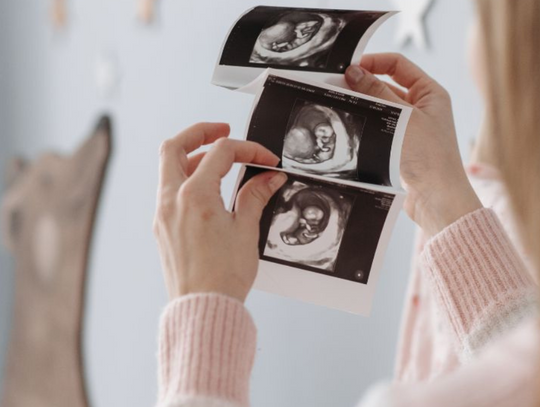 Od teraz badanie prenatalne są dla każdej ciężarnej. Bez żadnych warunków